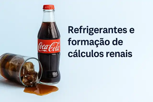 Imagem ilustrativa de refrigerantes e cálculo renal usada em artigo do Dr. Pedro Bastos, urologista em Juiz de Fora